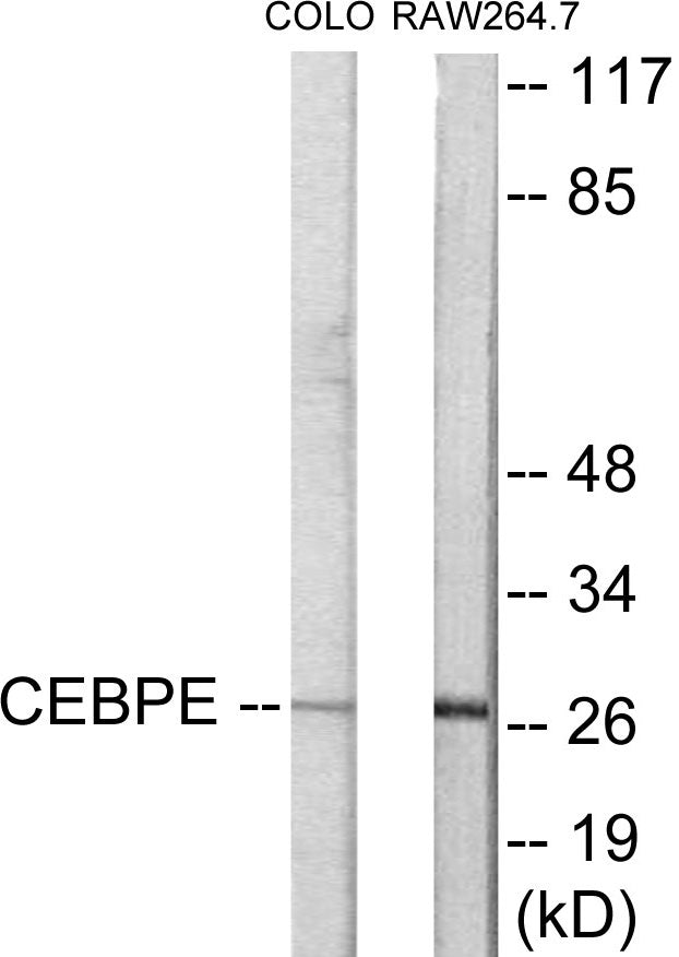 CEBPD/E Colorimetric Cell-Based ELISA