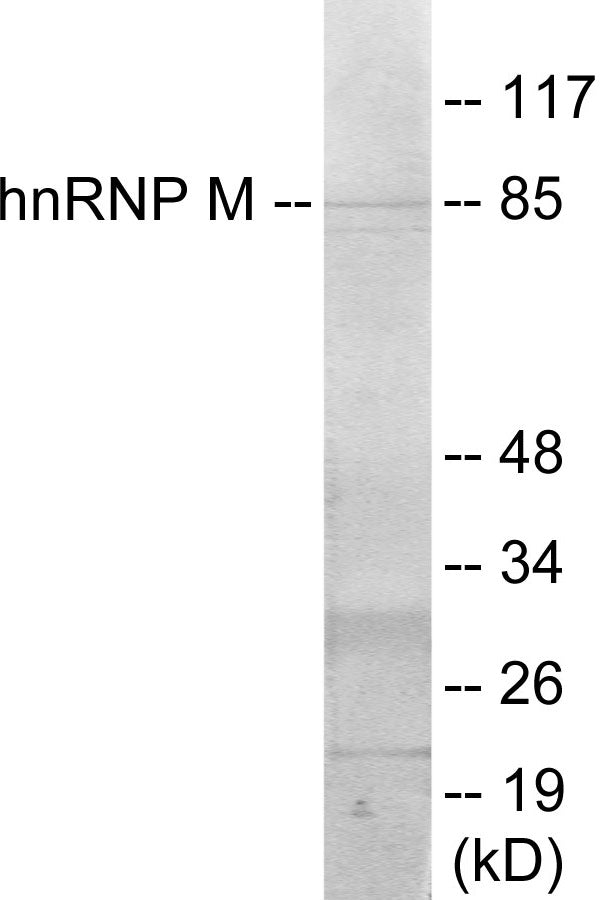 hnRNP M Colorimetric Cell-Based ELISA