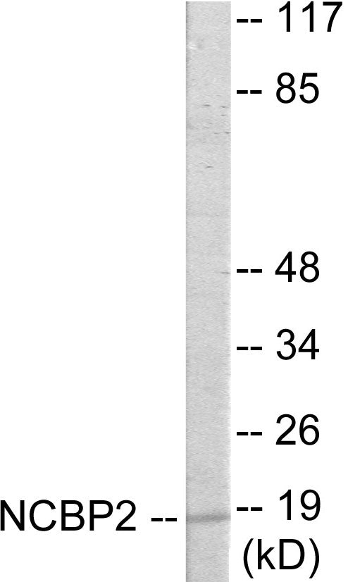 NCBP2 Colorimetric Cell-Based ELISA