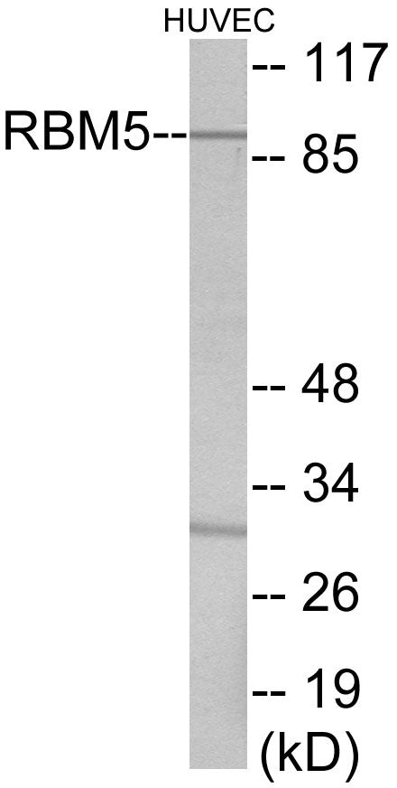 RBM5 Colorimetric Cell-Based ELISA