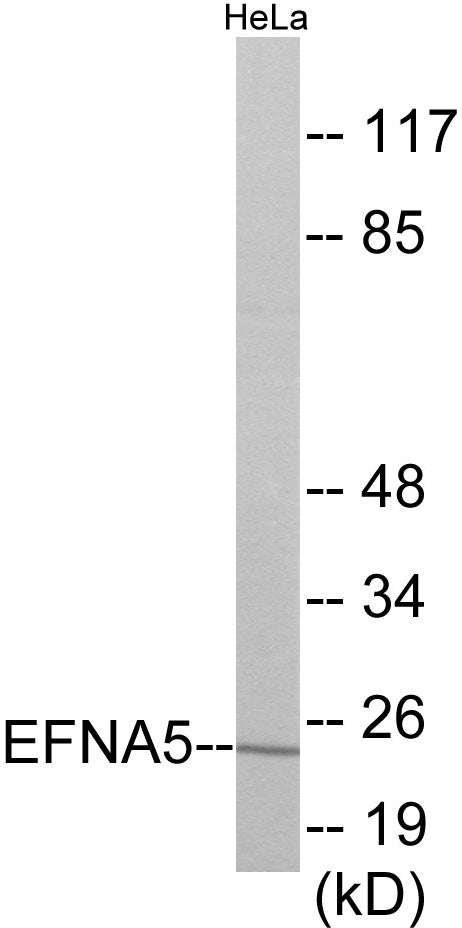 EFNA5 Colorimetric Cell-Based ELISA
