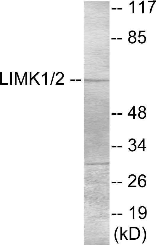 LIMK1 Colorimetric Cell-Based ELISA