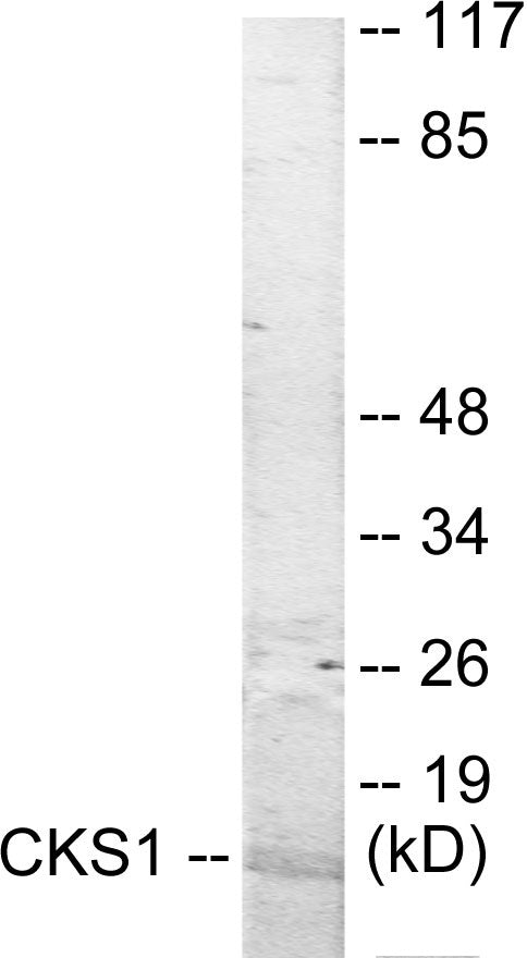 CKS1 Colorimetric Cell-Based ELISA