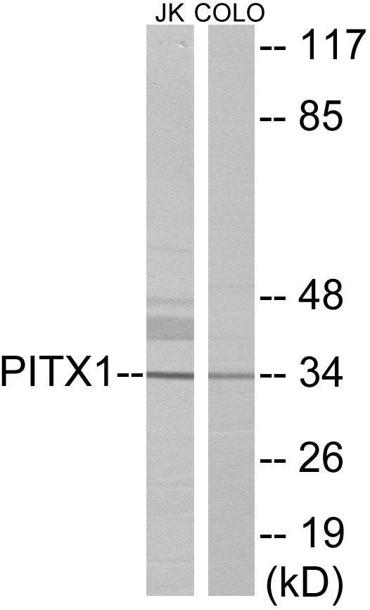 PITX1 Colorimetric Cell-Based ELISA