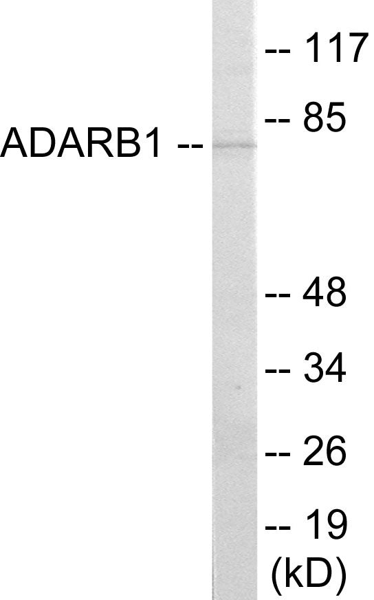 ADARB1 Colorimetric Cell-Based ELISA