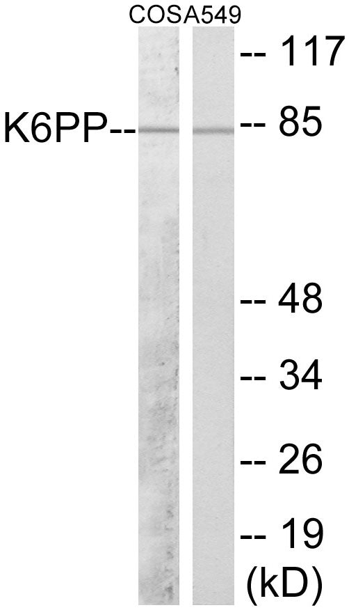 K6PP Colorimetric Cell-Based ELISA