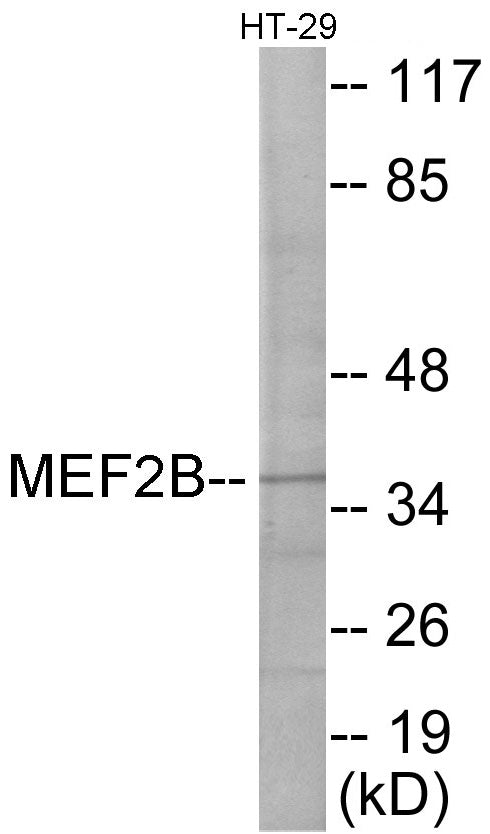MEF2B Colorimetric Cell-Based ELISA