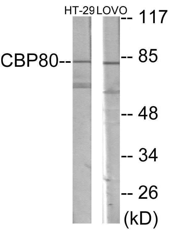 NCBP1 Colorimetric Cell-Based ELISA
