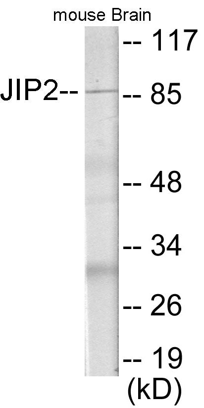 JIP2 Colorimetric Cell-Based ELISA