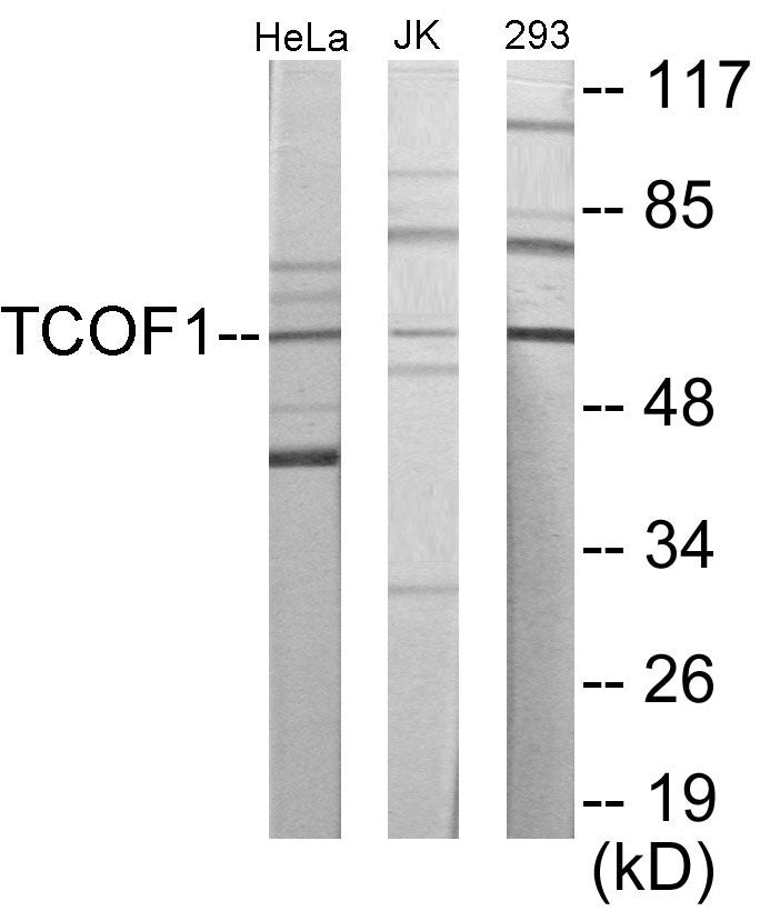 TCOF1 Colorimetric Cell-Based ELISA