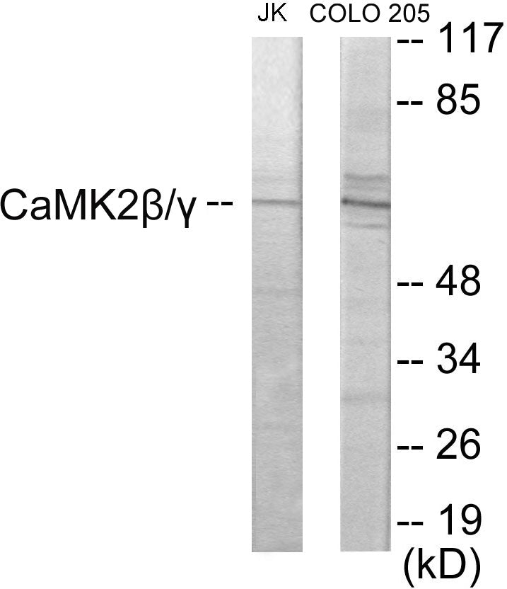 CaMK2 beta/gamma Colorimetric Cell-Based ELISA