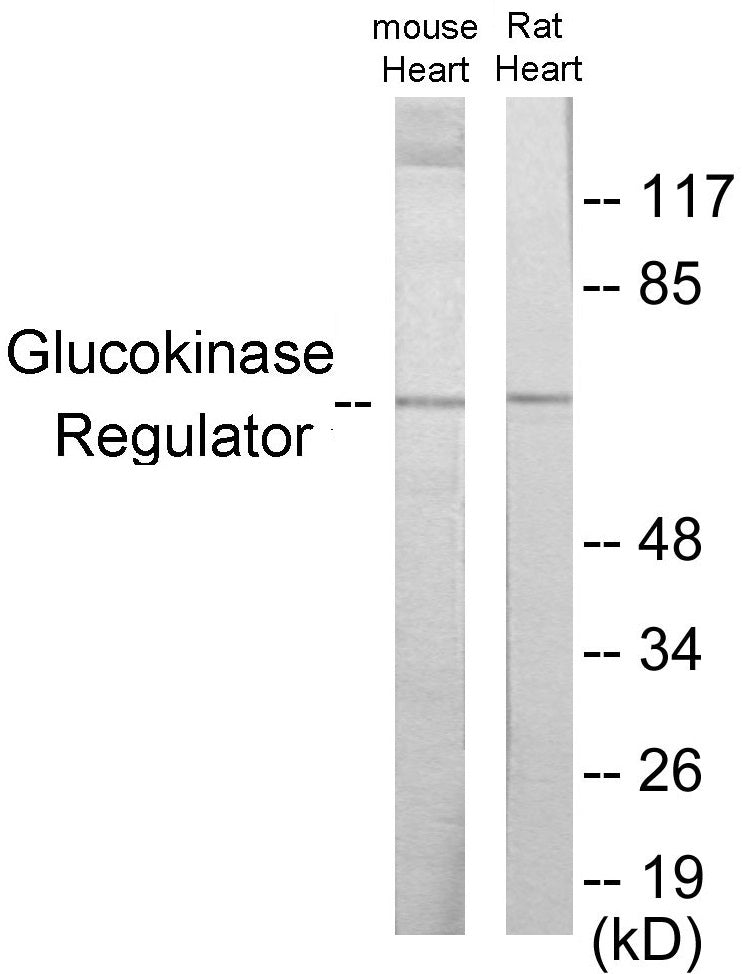 Glucokinase Regulator Colorimetric Cell-Based ELISA