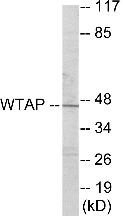 WTAP Colorimetric Cell-Based ELISA