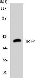 IRF4 Colorimetric Cell-Based ELISA