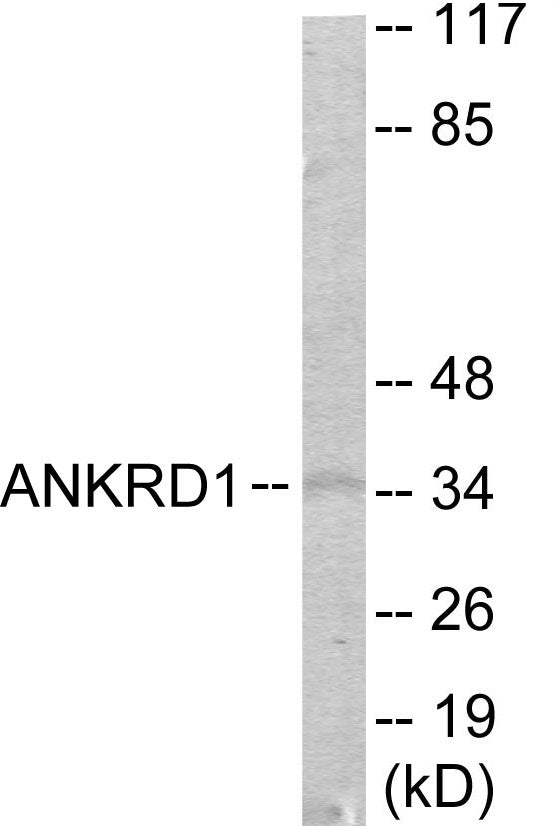 ANKRD1 Colorimetric Cell-Based ELISA