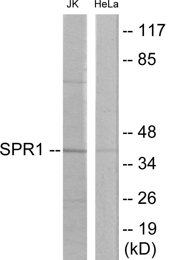 SPR1 Colorimetric Cell-Based ELISA