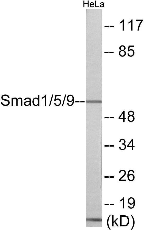 Smad1/5/9 Colorimetric Cell-Based ELISA