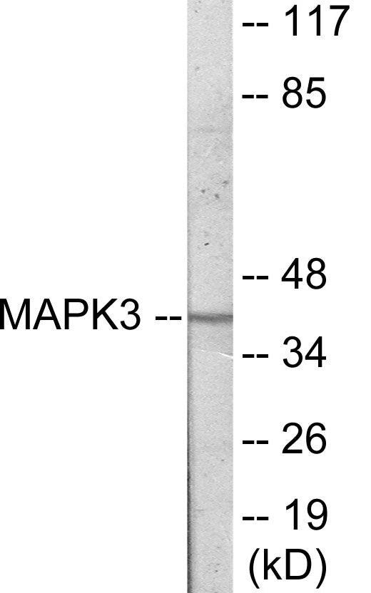 MAPK3 Colorimetric Cell-Based ELISA