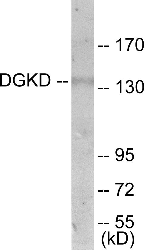 DGKD Colorimetric Cell-Based ELISA