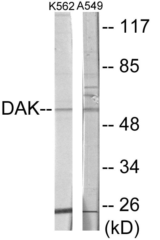 DAK Colorimetric Cell-Based ELISA