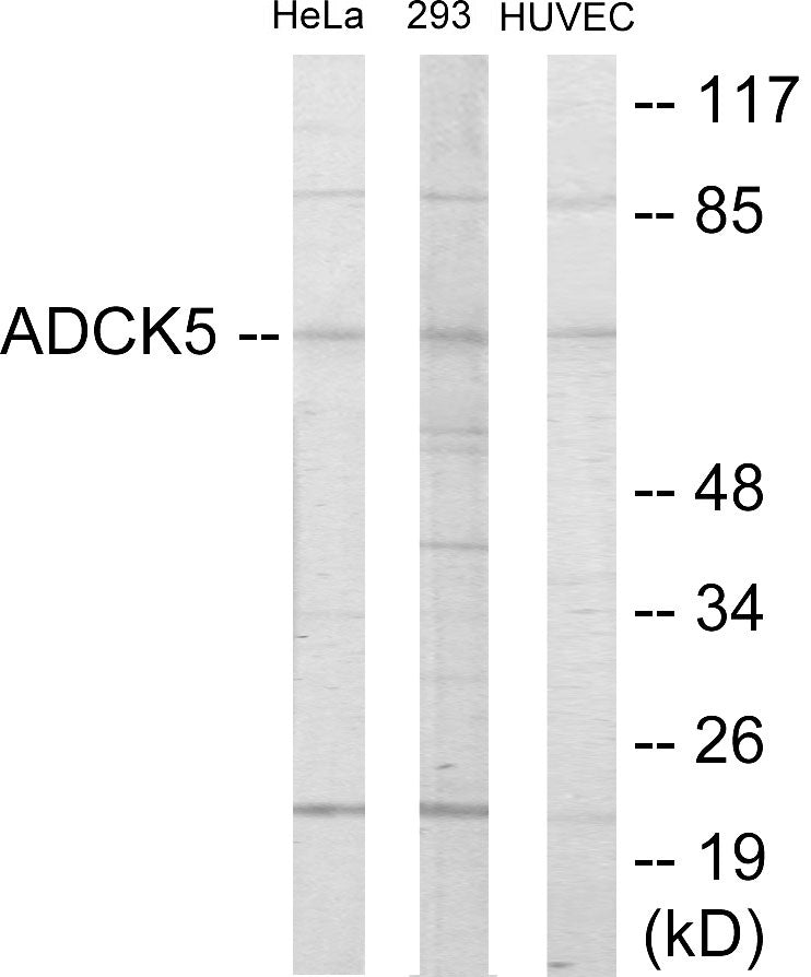 ADCK5 Colorimetric Cell-Based ELISA