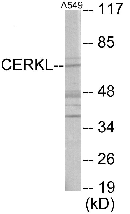 CERKL Colorimetric Cell-Based ELISA