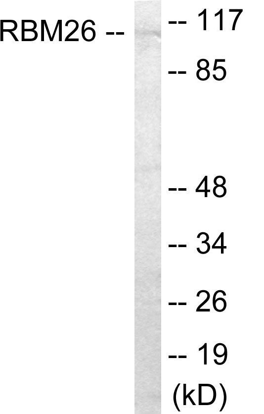RBM26 Colorimetric Cell-Based ELISA