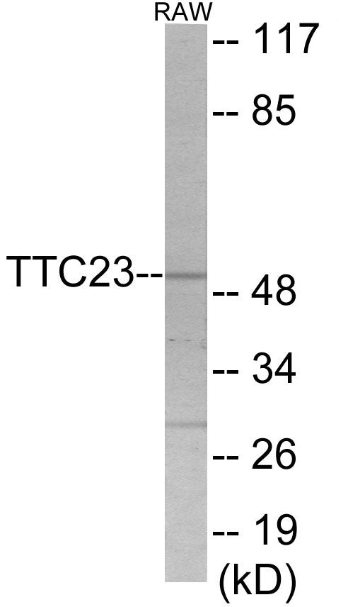 TTC23 Colorimetric Cell-Based ELISA
