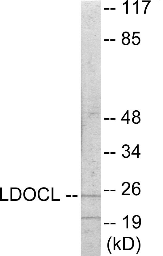 LDOC1L Colorimetric Cell-Based ELISA