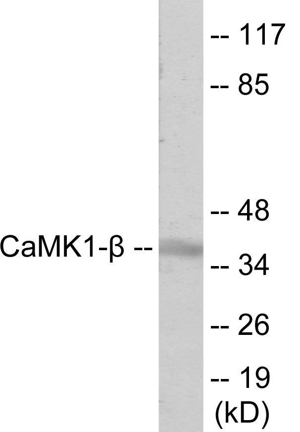 CaMK1-beta Colorimetric Cell-Based ELISA