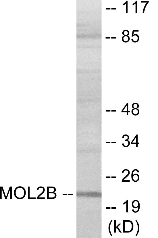 MOBKL2B Colorimetric Cell-Based ELISA