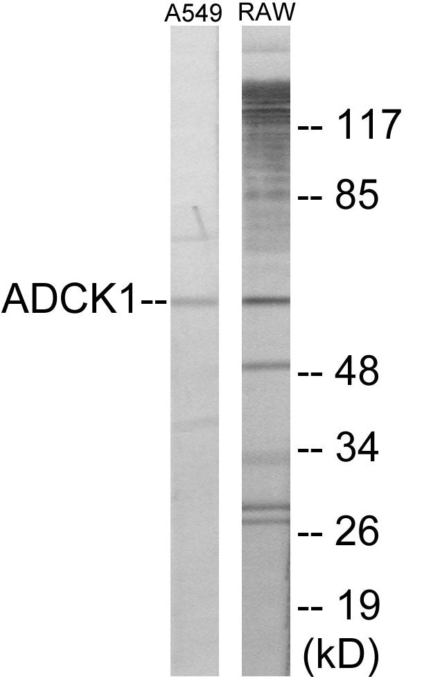 ADCK1 Colorimetric Cell-Based ELISA