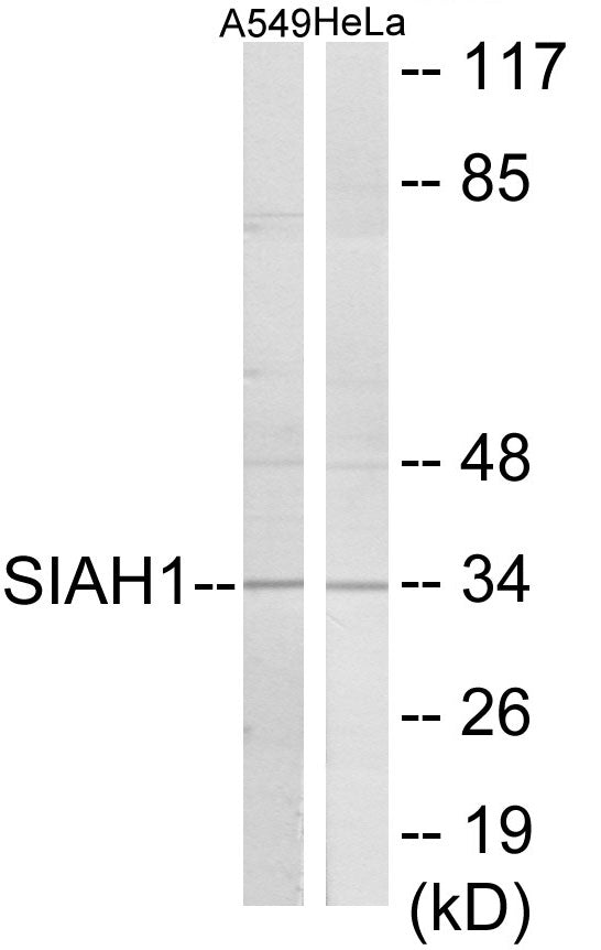 SIAH1 Colorimetric Cell-Based ELISA