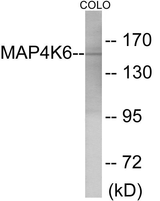 MAP4K6 Colorimetric Cell-Based ELISA