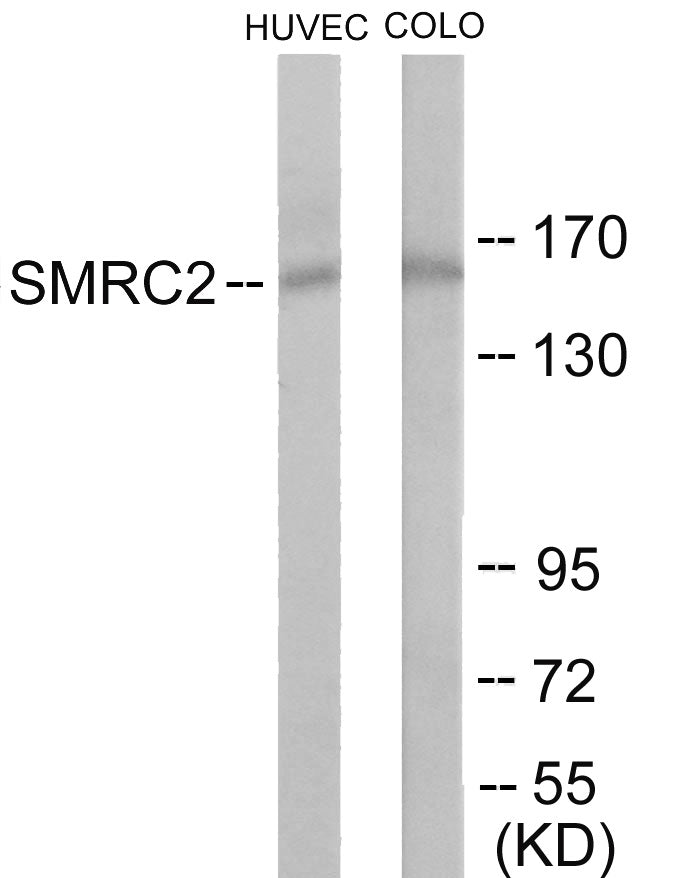SMRC2 Colorimetric Cell-Based ELISA