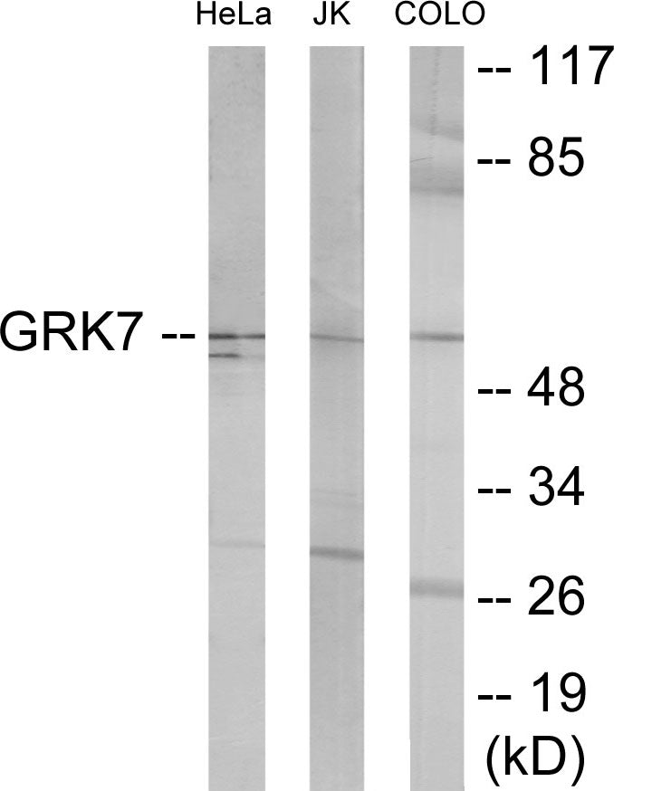 GRK7 Colorimetric Cell-Based ELISA