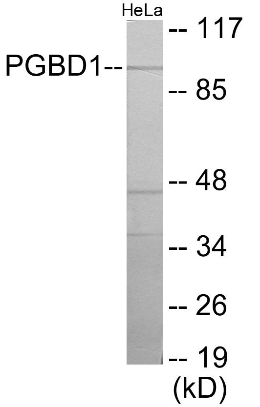 PGBD1 Colorimetric Cell-Based ELISA
