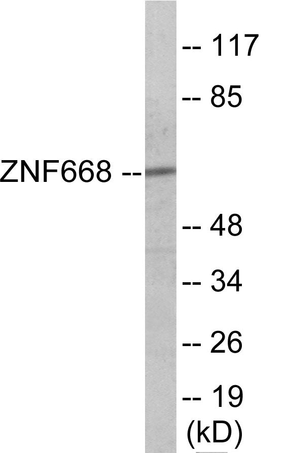 ZNF668 Colorimetric Cell-Based ELISA