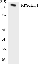 RPS6KC1 Colorimetric Cell-Based ELISA