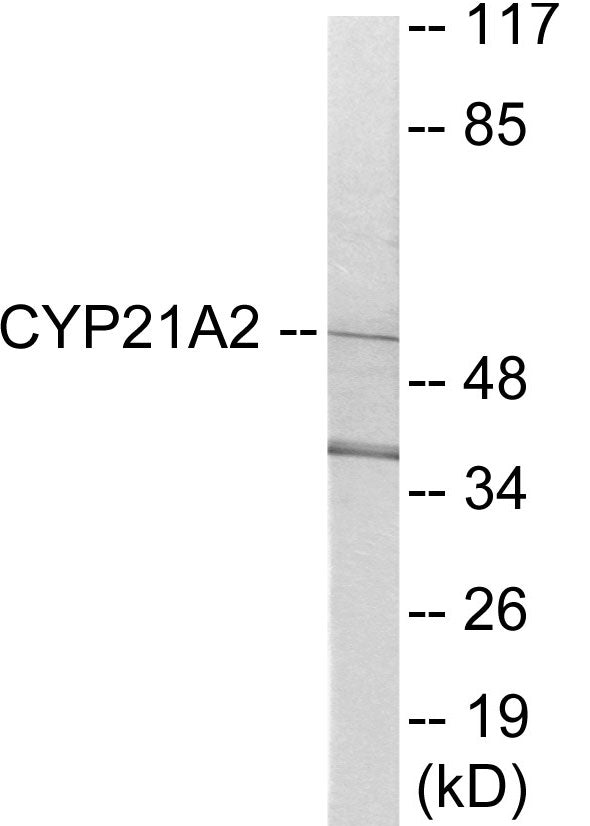 Cytochrome P450 21A2 Colorimetric Cell-Based ELISA