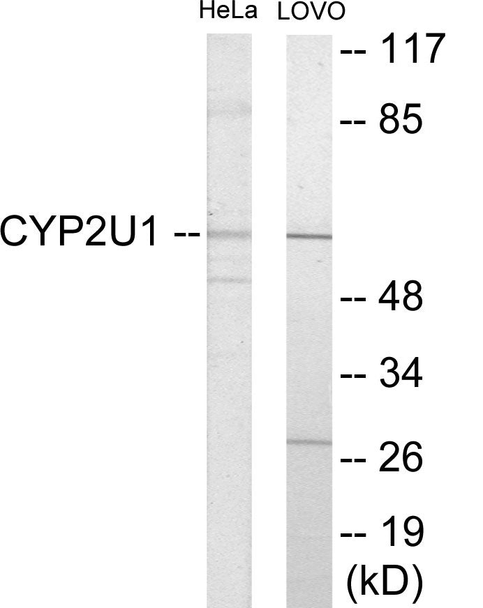 Cytochrome P450 2U1 Colorimetric Cell-Based ELISA