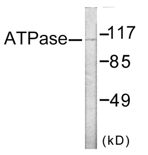 ATPase Colorimetric Cell-Based ELISA