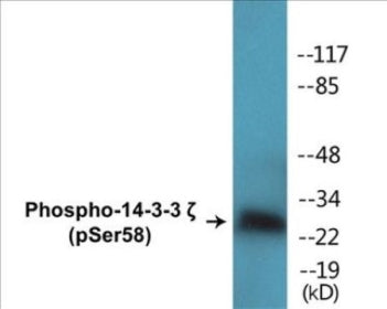 Phospho-14-3-3 zeta (Ser58) Colorimetric Cell-Based ELISA Kit