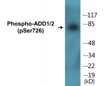 Phospho-ADD1/2 (Ser726) Colorimetric Cell-Based ELISA Kit