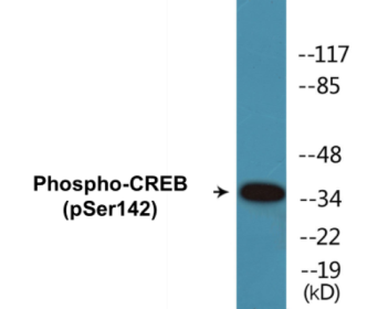 Phospho-CREB (Ser142) Colorimetric Cell-Based ELISA Kit