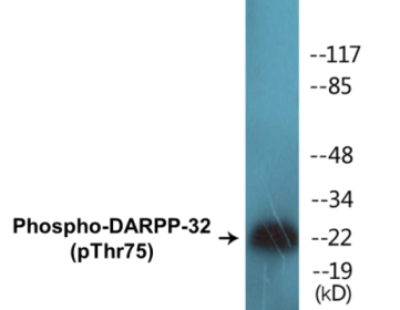 Phospho-DARPP-32 (Thr75) Colorimetric Cell-Based ELISA Kit