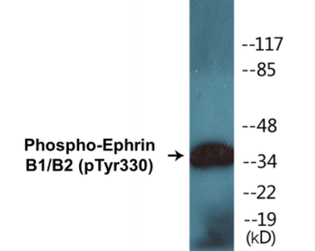 Phospho-Ephrin B1/B2 (Tyr330) Colorimetric Cell-Based ELISA Kit