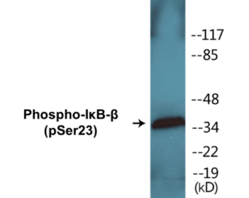 Phospho-IκB-beta (Ser23) Colorimetric Cell-Based ELISA Kit