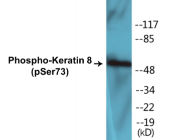 Phospho-Keratin 8 (Ser73) Colorimetric Cell-Based ELISA Kit