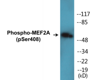 Phospho-MEF2A (Ser408) Colorimetric Cell-Based ELISA Kit